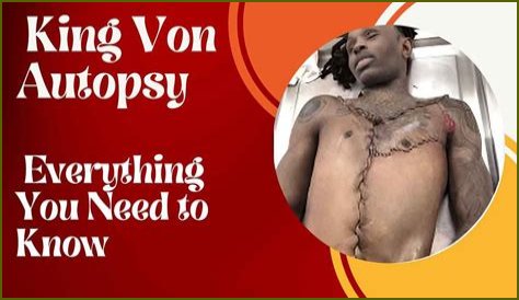 Unseen Autopsy Images Of King Von: The Tragic Aftermath Revealed